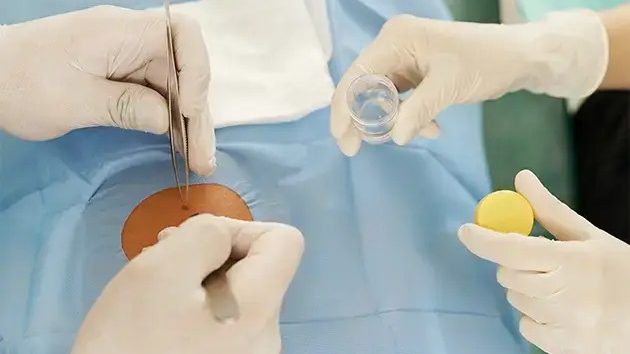 Paediatric Dermatology